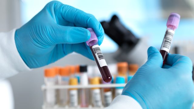 How a new blood test could revolutionise sepsis diagnosis
