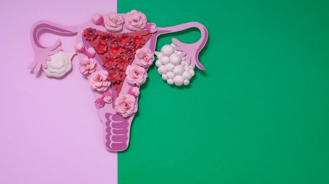 Polycystic ovary syndrome: What it is, how it's treated and why it's often misunderstood
