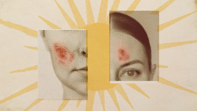 Climate change is getting under our skin