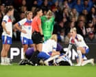 Could the ‘notch’ be key to understanding ACL injuries in women’s football?