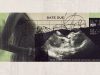 The rise in unregulated pregnancy scans