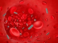 Sepsis ‘breakthrough’: the world’s first targeted treatment?