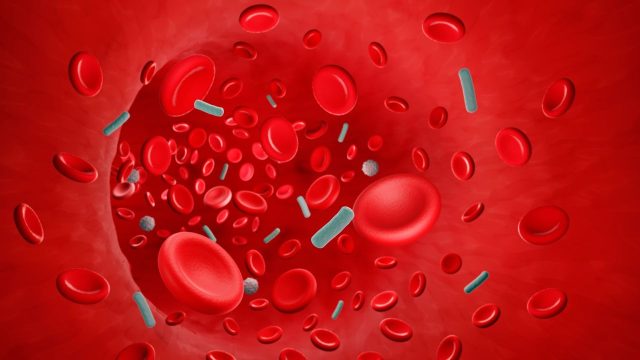 Sepsis ‘breakthrough’: the world’s first targeted treatment?