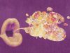 Did Trump’s policies open the path for Ebola outbreak?