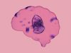 Brain-eating amoeba found in popular recreation areas