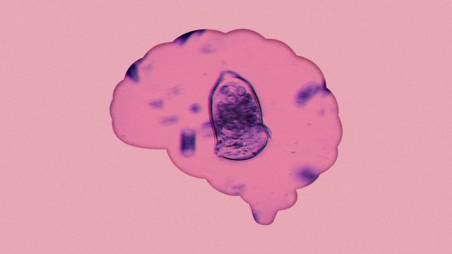 Brain-eating amoeba found in popular recreation areas