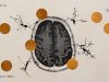 A copper drug could boost memory in Alzheimer’s patients