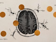 A copper drug could boost memory in Alzheimer’s patients
