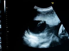 Wearable ultrasound tracks high-risk pregnancies: The Week’s Good News