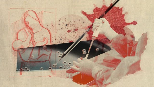 Unproven, experimental stem cell treatments for autistic children are on the rise