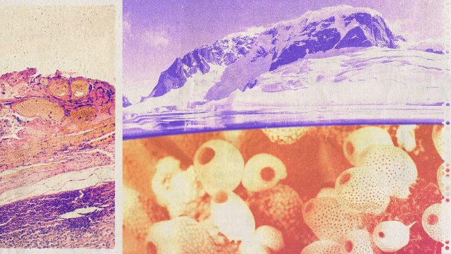 An Antarctic sea squirt could help treat melanoma