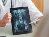 How precision medicine is revolutionising healthcare